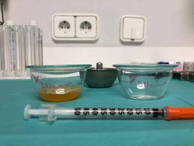 Fotos cirugía bucal - implantes y sedación