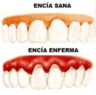Consejos para la Salud Bucodental