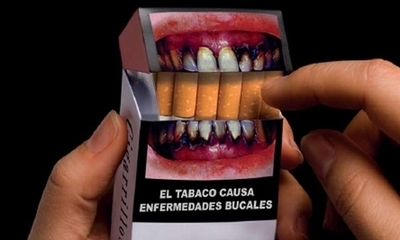 Consejos para la Salud Bucodental