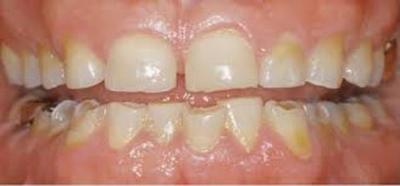 Consejo para la Salud Bucodental