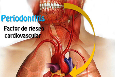 Consejos para la Higiene Bucodental