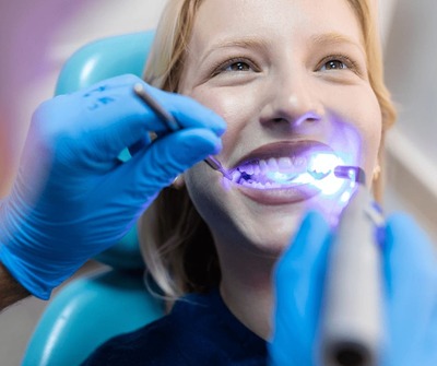 BLANQUEAMIENTO DENTAL
